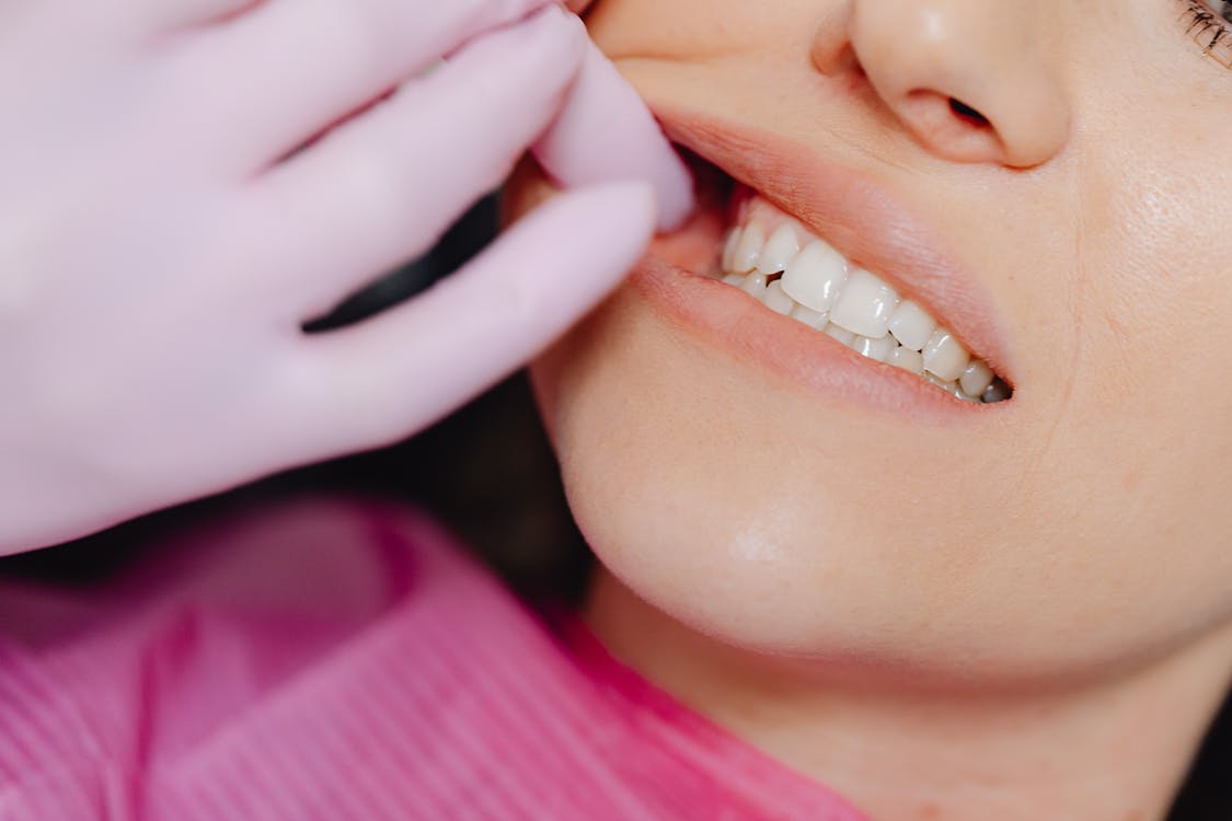 Free Fotos de stock gratuitas de boca, chequeo, cuidado dental Stock Photo